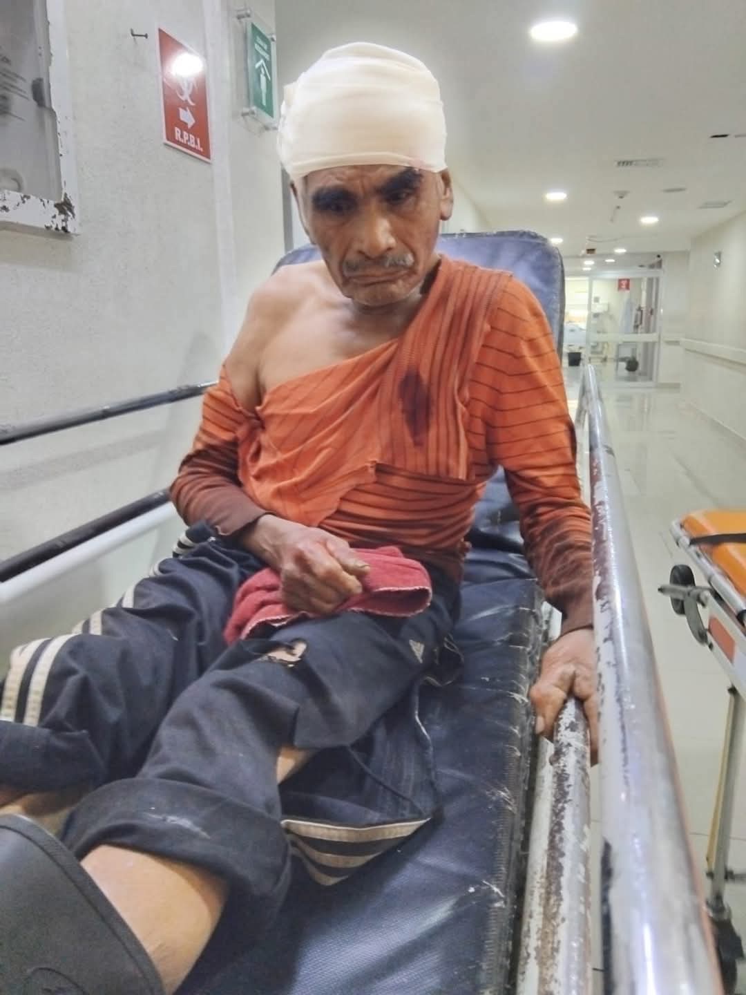 LOCALIZAN A MASCULINO ATROPELLADO