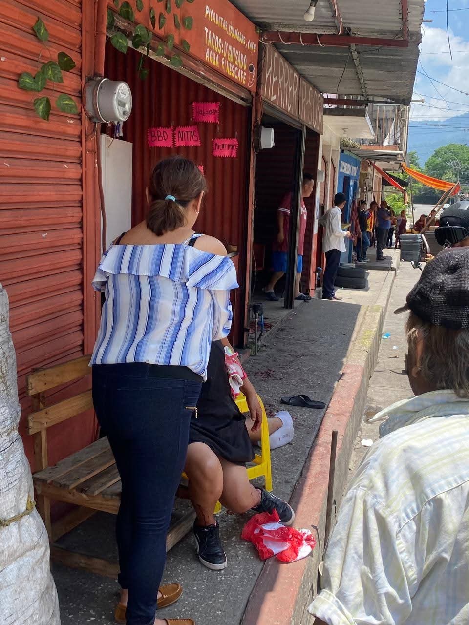 A PLENA LUZ, BALEAN NEGOCIO